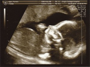 baby_20_weeks